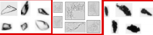 Figure 1 : MFI donne des comptages et des tailles plus précis avec des détails morphologiques complets pour toutes les particules subvisibles dans votre échantillon d'agrégats de protéines.